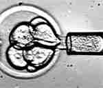 Un grupo de investigadores estadounidenses dice haber creado por primera vez células madre embrionarias humanas sin destruir los embriones.