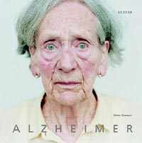 El mal de Alzheimer es una enfermedad física progresiva que afecta el cerebro.